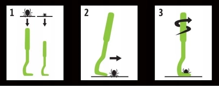 TICK REMOVER – Zestaw do Usuwania Kleszczy 